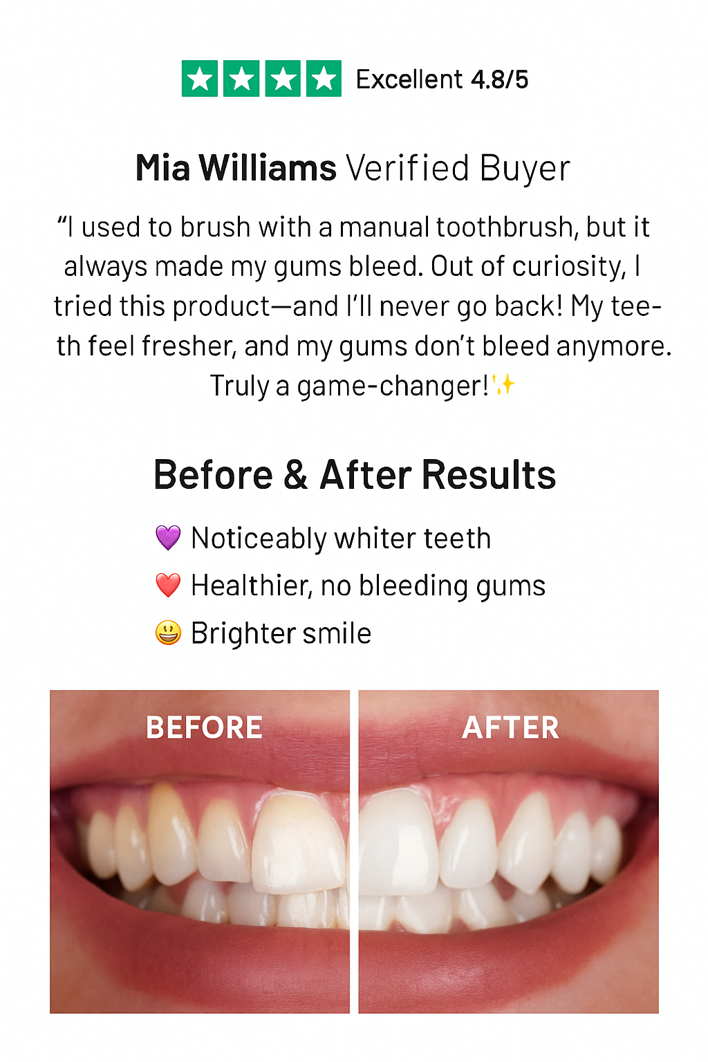 LUMODENTIX™ — Automatic U-shaped Toothbrush